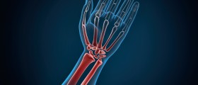 Types Of Spondylitis: Spondyloarthritis Vs Ankylosing Spondylitis